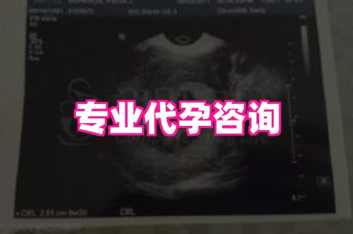 长春助孕网 4